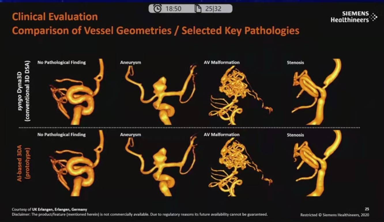 降低|神经介入领域新技术展望