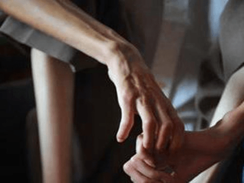 治疗|运动神经元病的治疗效果如何