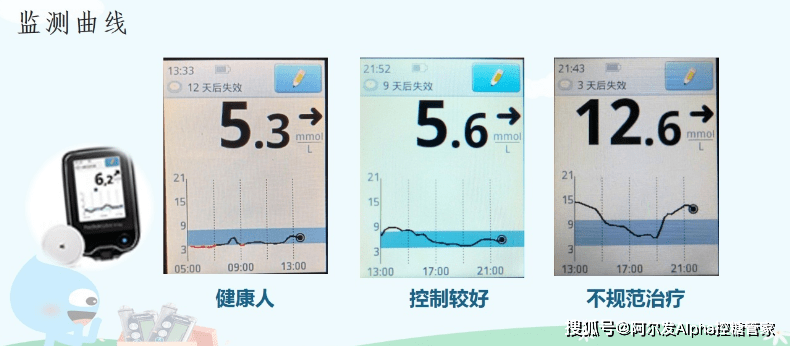 监测|《中国血糖监测临床应用指南（2021年版）》摘要