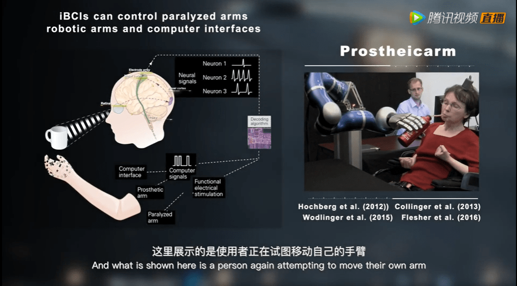接口|2021腾讯科学WE大会---脑机接口技术