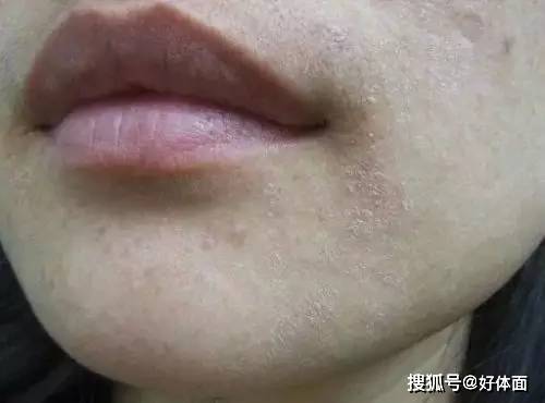 分子来，重新认识下，让肌肤喝撑了的保湿小天才