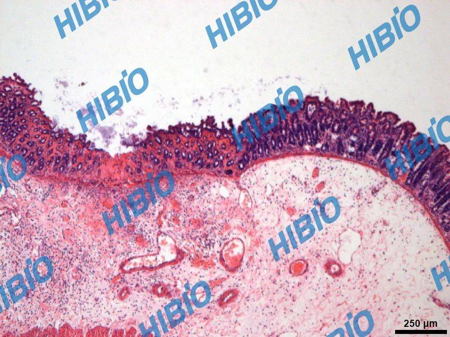 消化系统疾病动物模型之胃溃疡