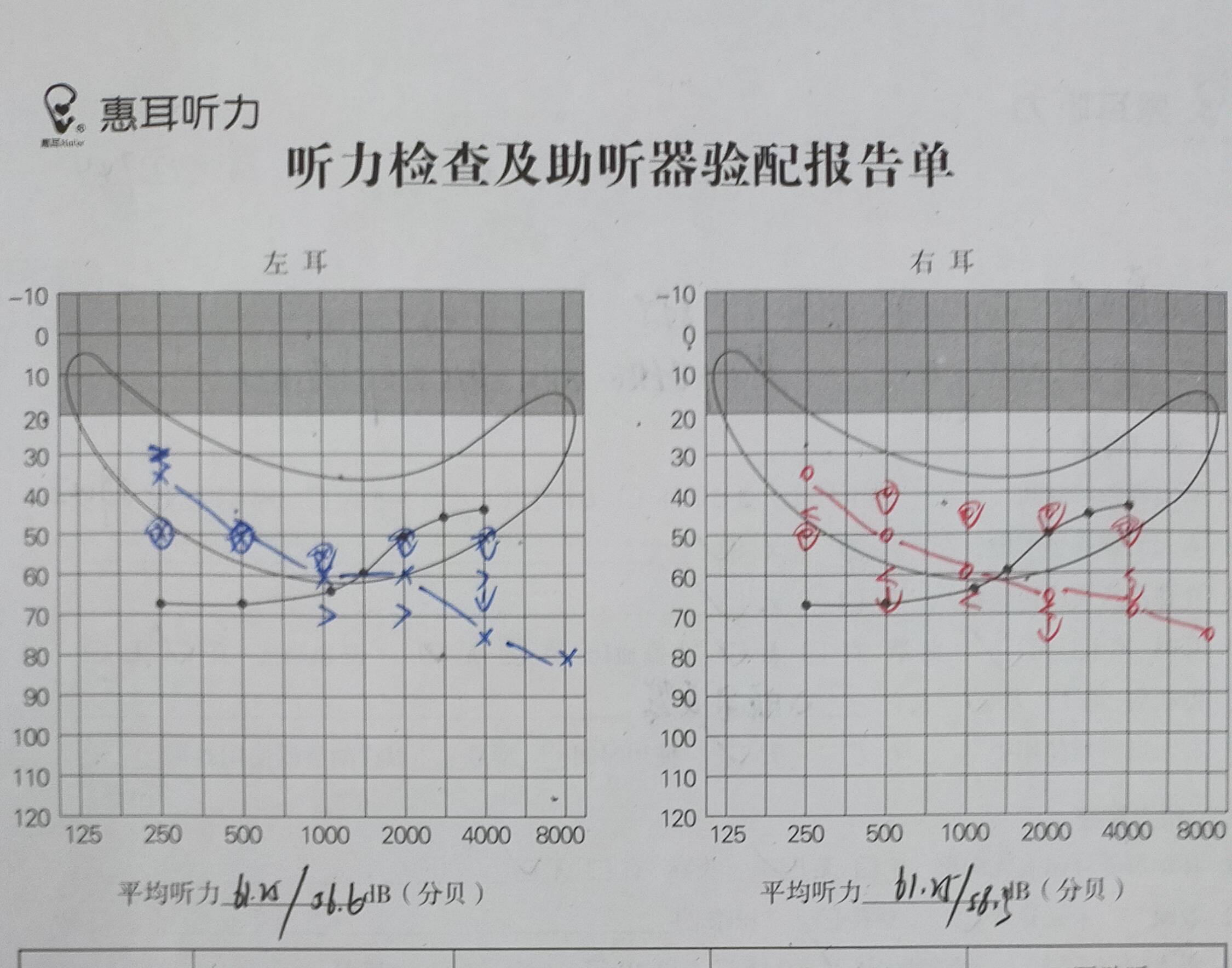 听力测试报告单图片