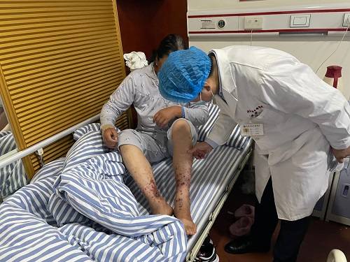 治愈|过敏性紫癜有哪些类型？能彻底治愈吗？