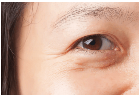 贵妇为什么天天贵妇抗衰老护肤，还是有细纹？