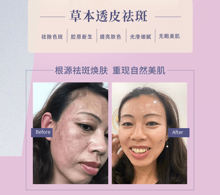 品牌汇聚国际旗下——聚致汇美、萃肌堂，引领祛斑祛痘新势能！