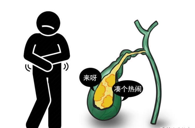 胆囊息肉b超图片图片