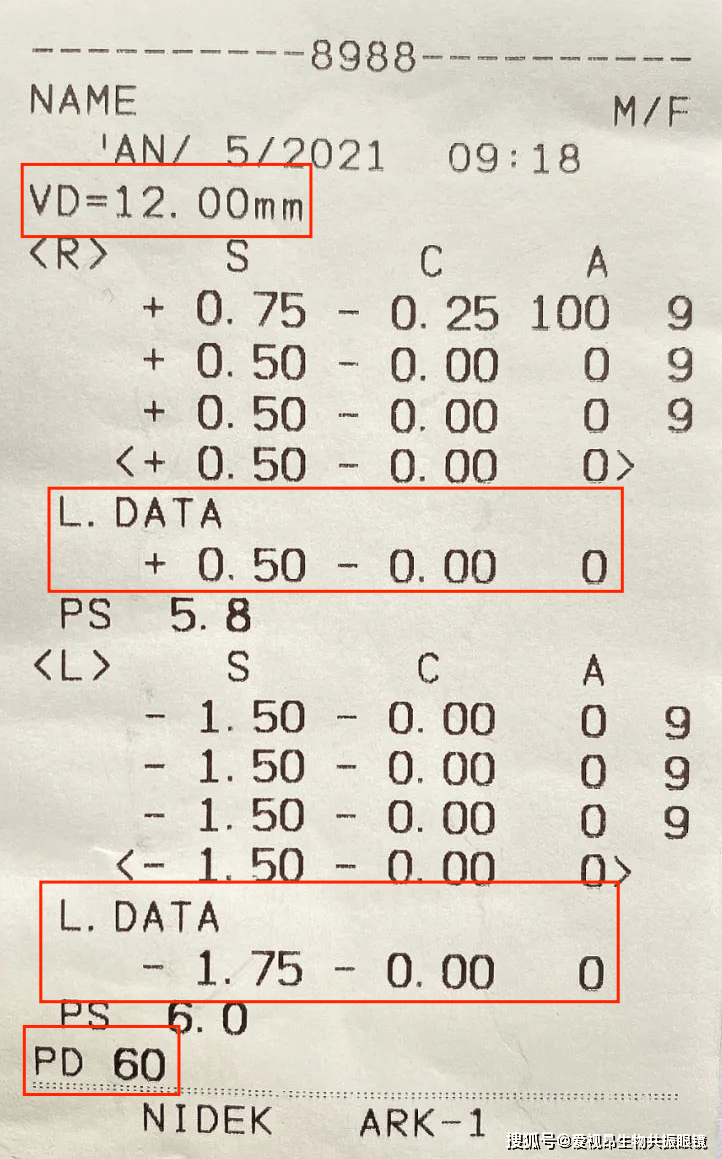 孩子_散光_视力