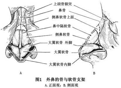 foho隆鼻有没有后遗症