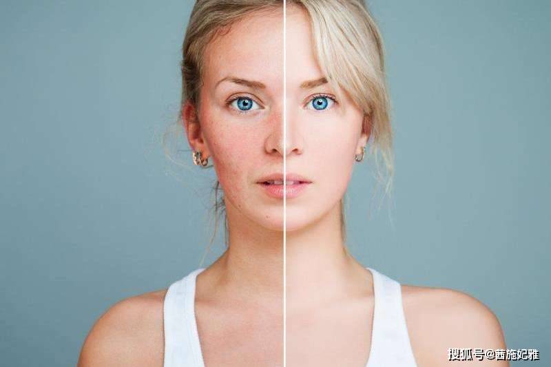 姐妹祛斑护肤总踩雷?几大祛斑谣言要注意!