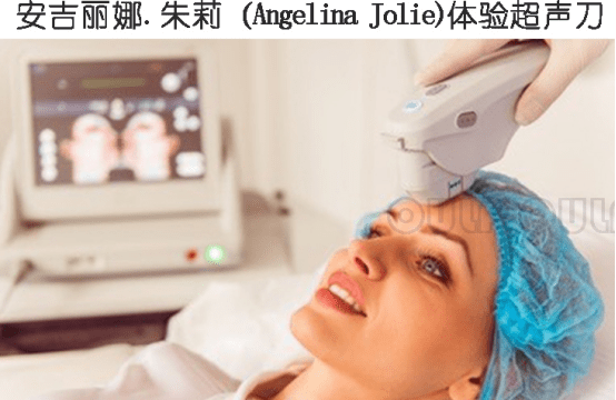 能量疑问：超声刀适合多大年龄的人做？超声刀美容能维持多久？