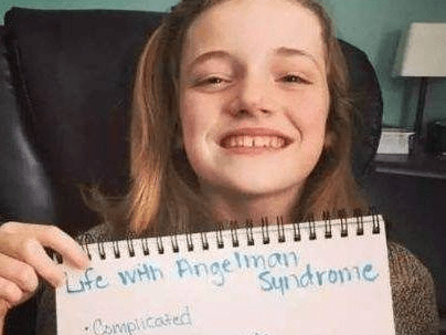 天使人综合症究竟是什么angelman综合征是一种复杂的遗传性疾病,主要