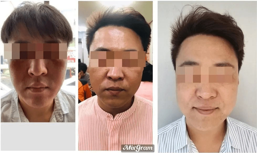 拜克漾拜克漾速美素蝮蛇毒肽复合物W丨深层滋养，美白嫩肤