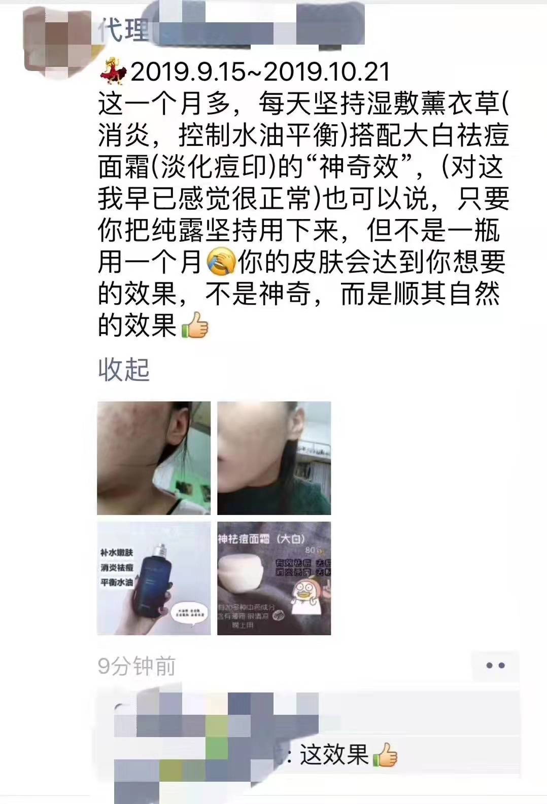 方法董欣薰衣草纯露消炎功效好嘛？痘痘肌敏感肌使用方法