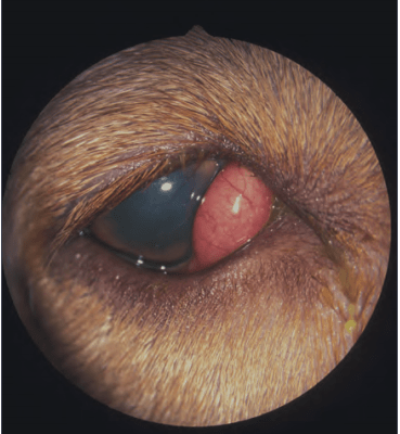 眼科专家解答什么是樱桃眼