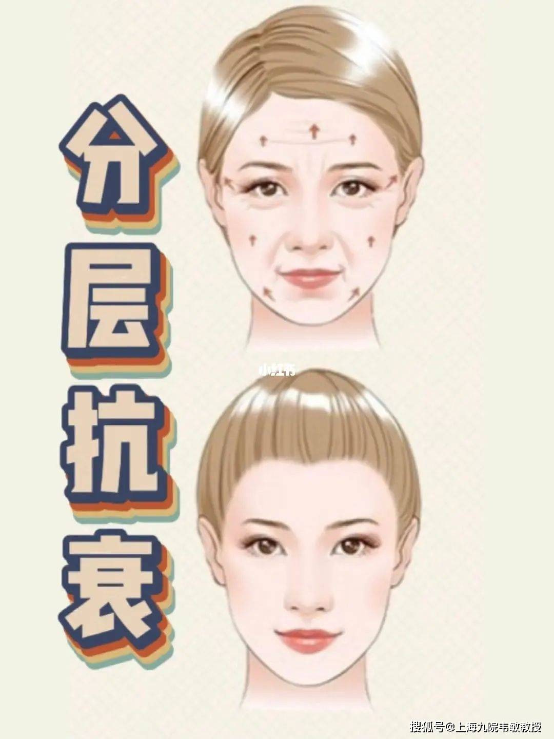 原创九院韦敏教授丨面部抗衰也要注意分区的问题你需要了解这些