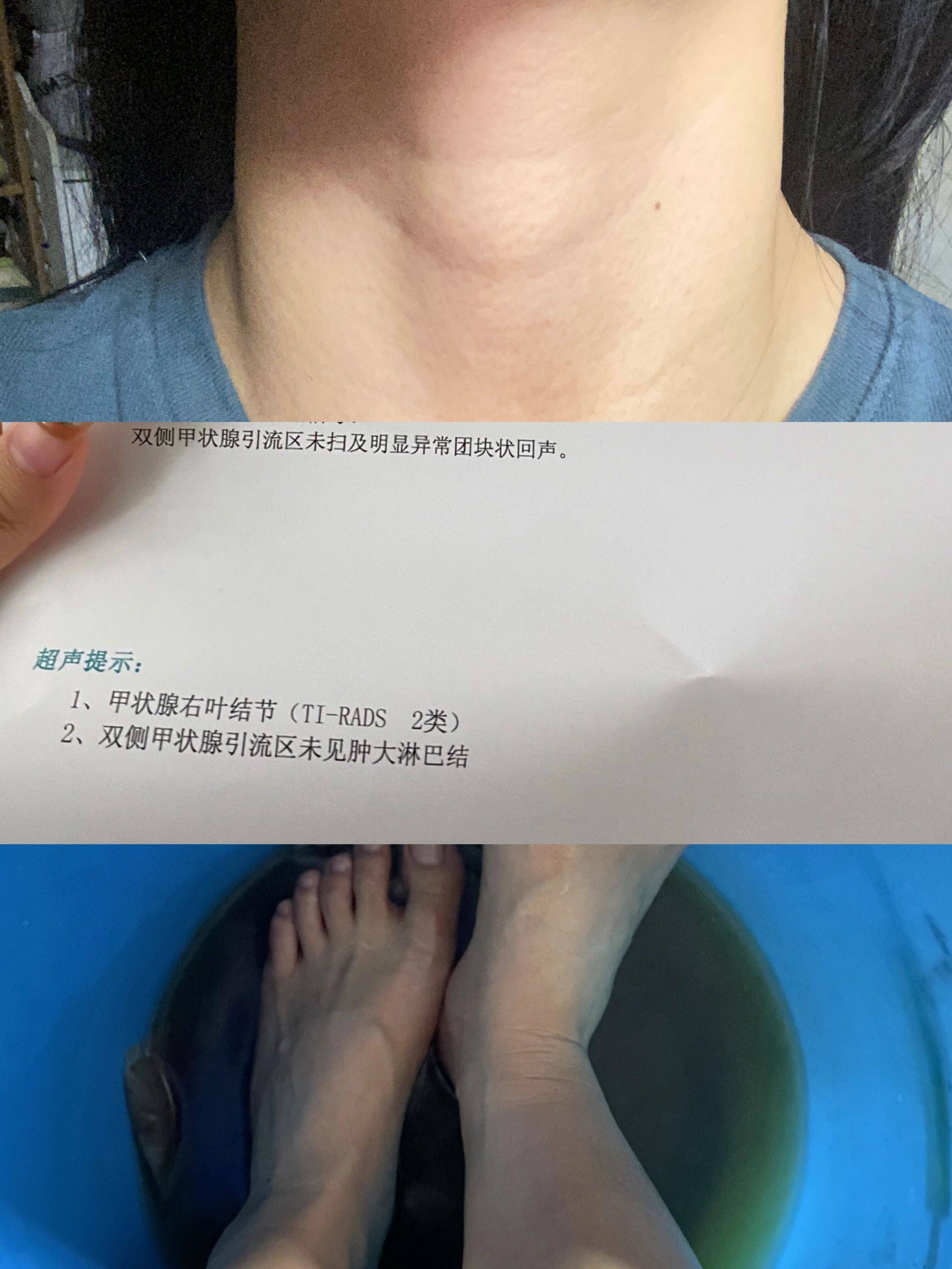 得通,结节得消,适合1-3类良性乳腺症增生,乳腺结节,甲状腺结节的女性