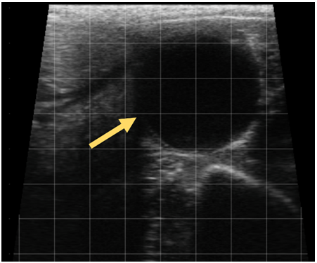 奶牛b超诊断妊娠图谱图片