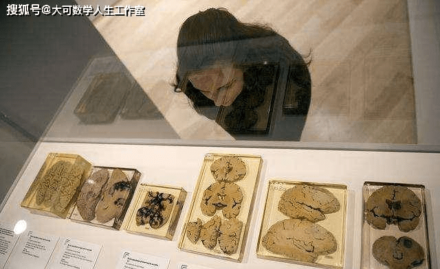和费城的马特博物馆,这两个博物馆都展出了一部分"大脑"