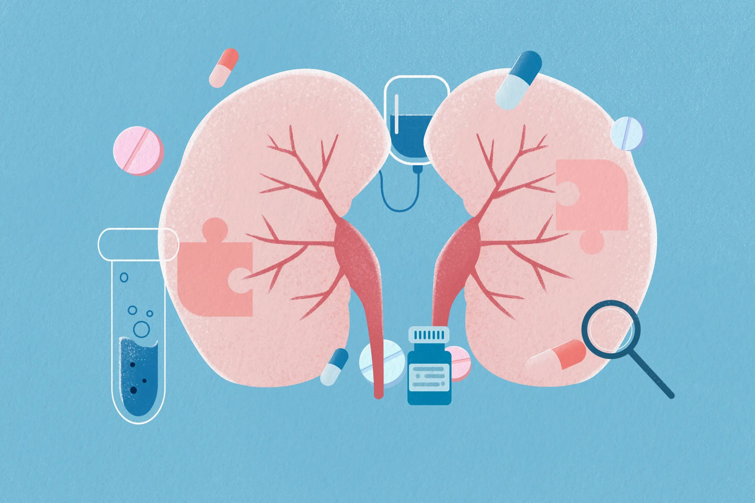 深圳复亚医院泌尿外科:泌尿系结石知多少?_患者_疾病_代谢