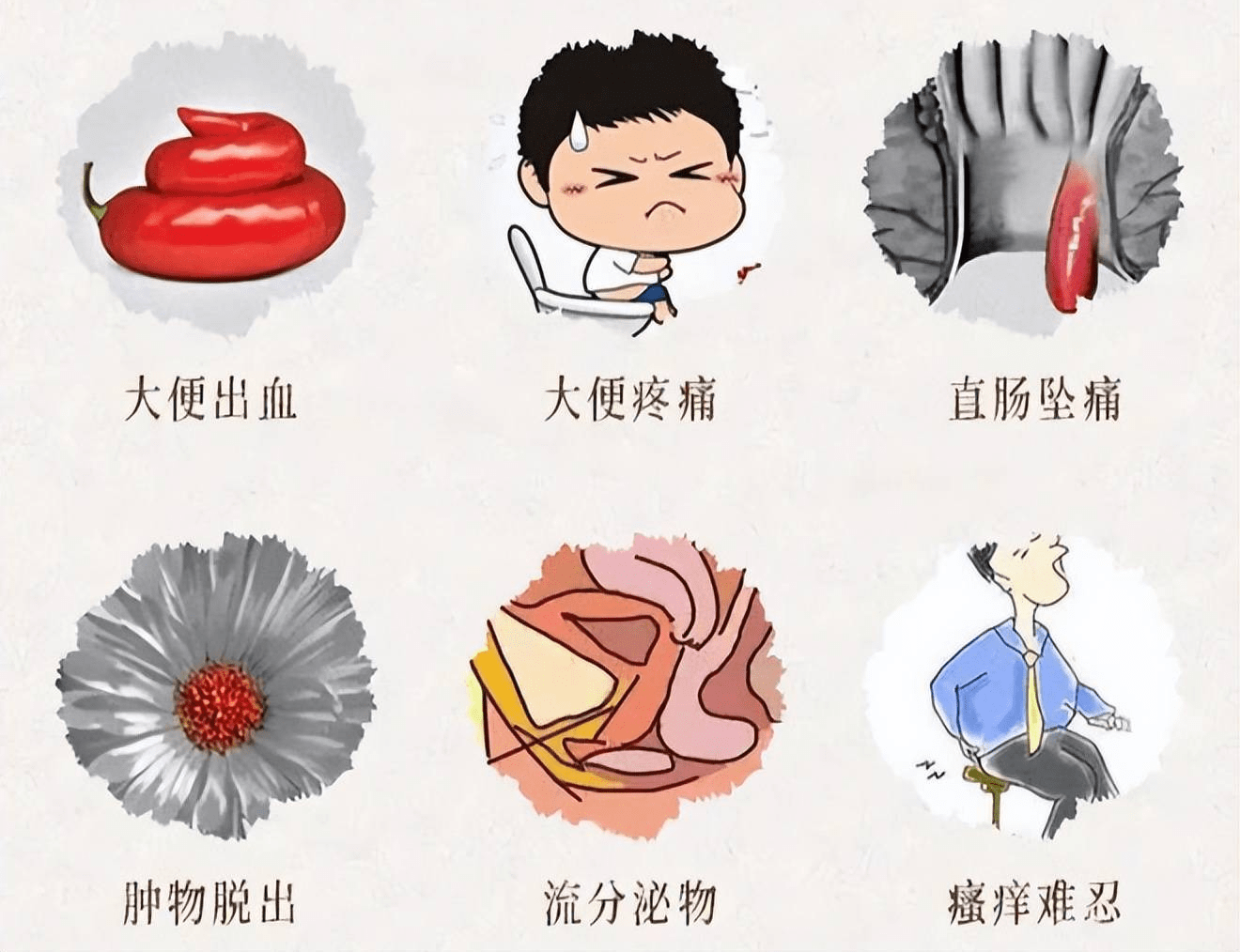 痔疮疼痛便血怎么办?预防和治疗痔疮要做到这5点