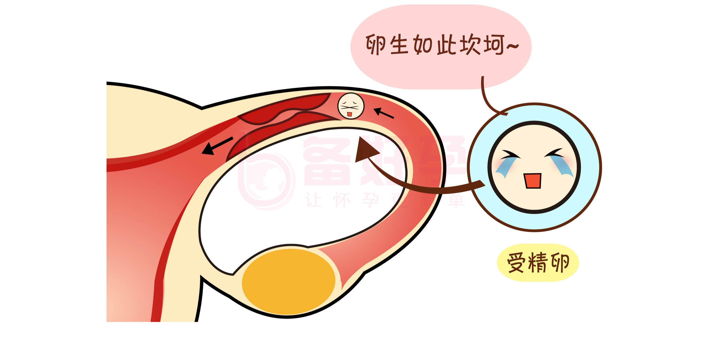 异位妊娠最常见的部位图片