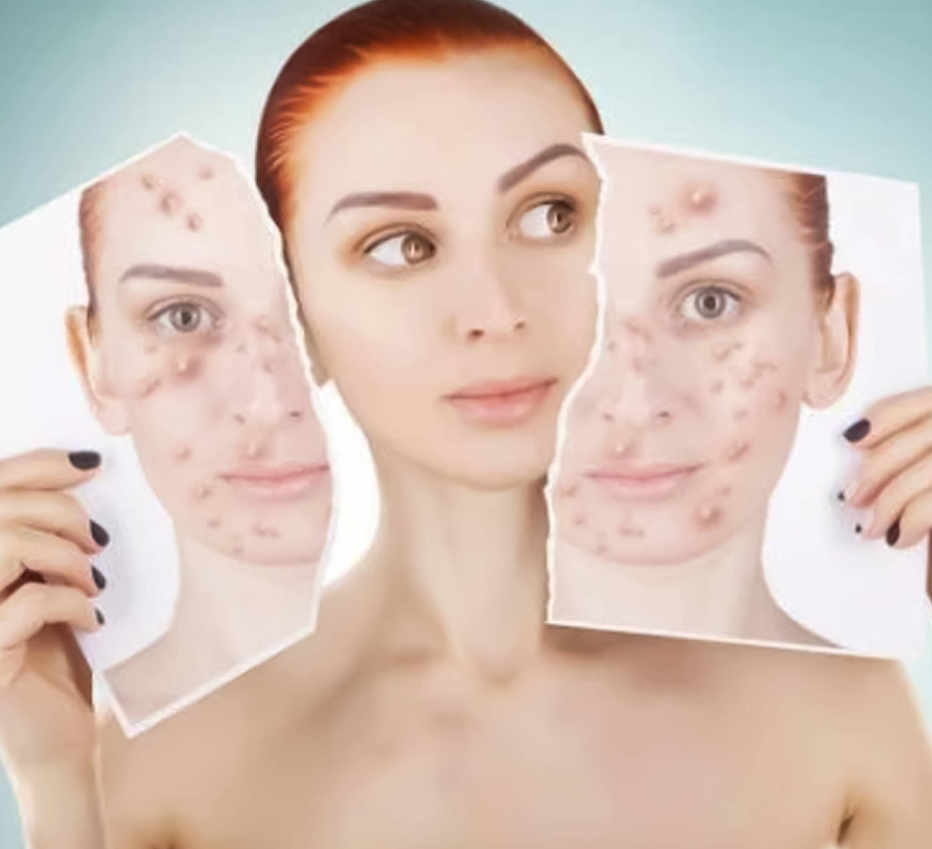 痘痘_皮肤_食物