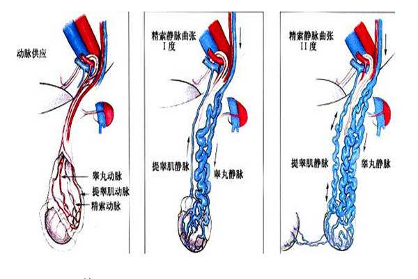 查体检查显示小陈的阴囊睾丸有坠胀和不适的感觉