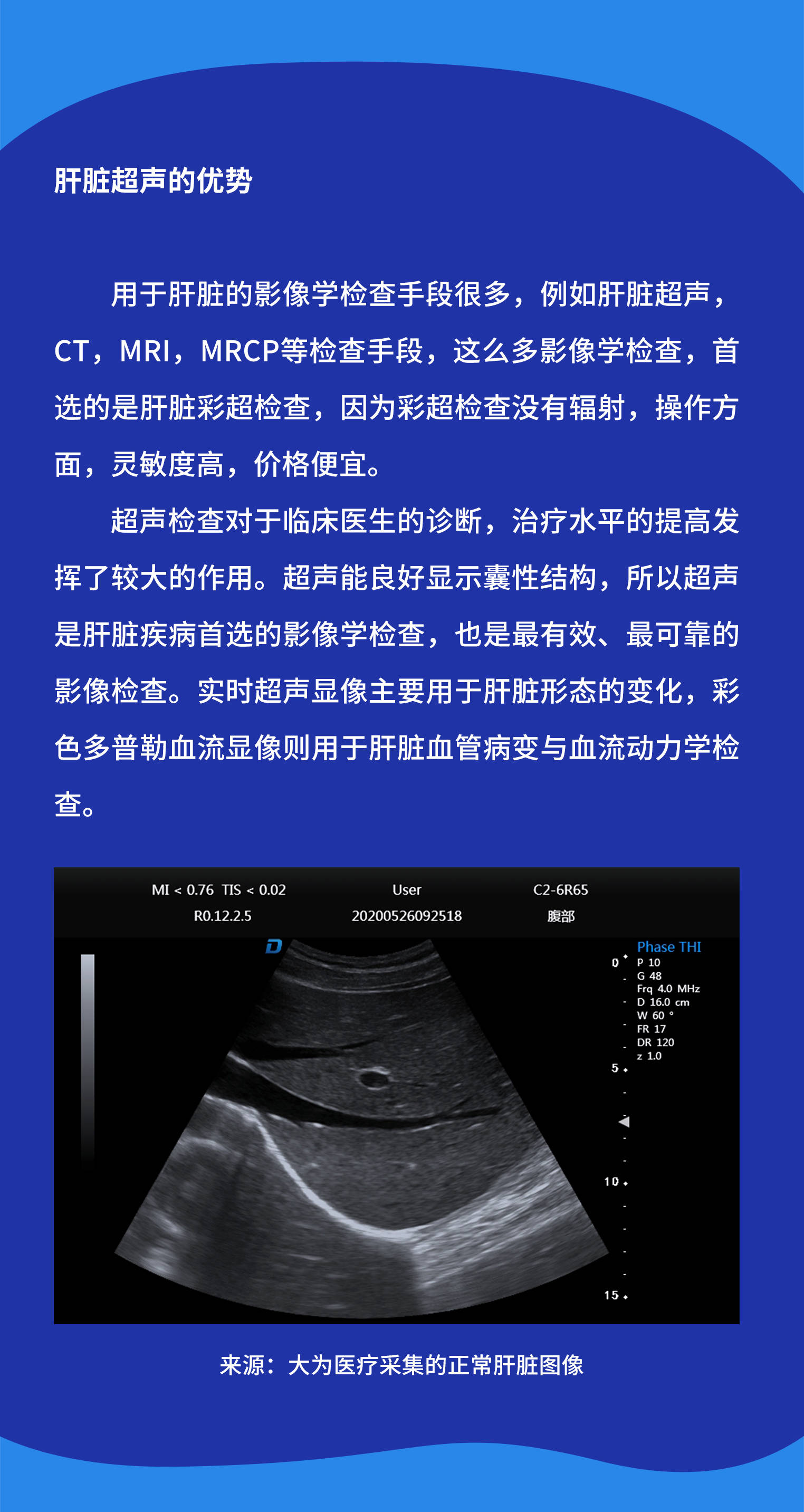 肝脏超声的优势?