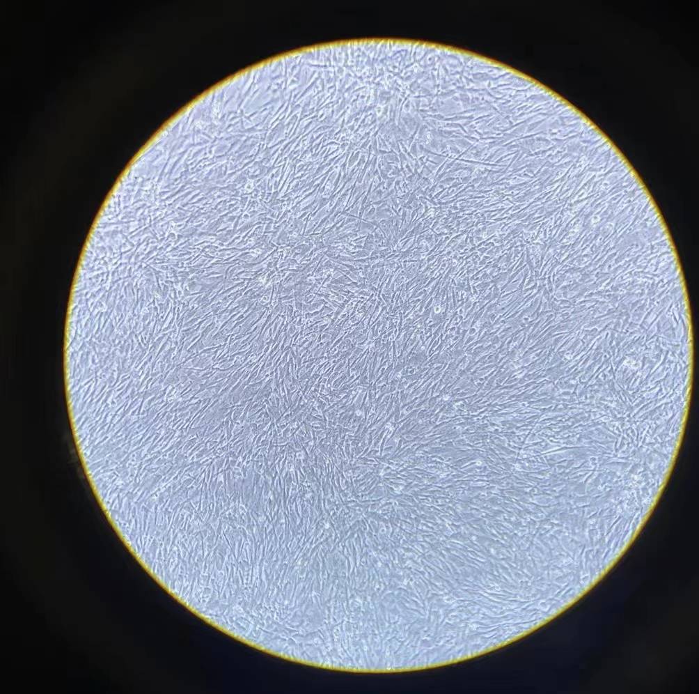 科普间充质干细胞治疗炎症性肠病的临床研究进展和挑战