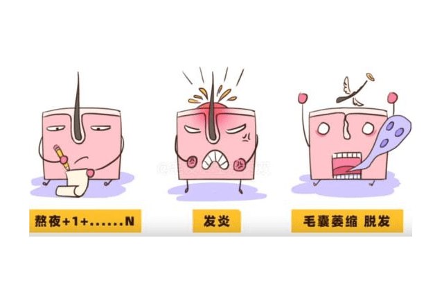毛囊炎与脱发有没有关呢?_头皮_人群_身体