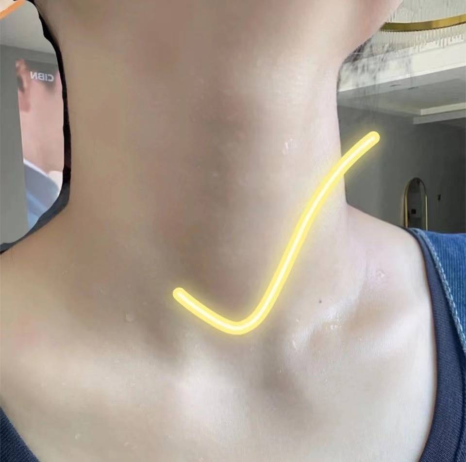 试试这个方法,45天就能消肿散结!_时候_建议_时间