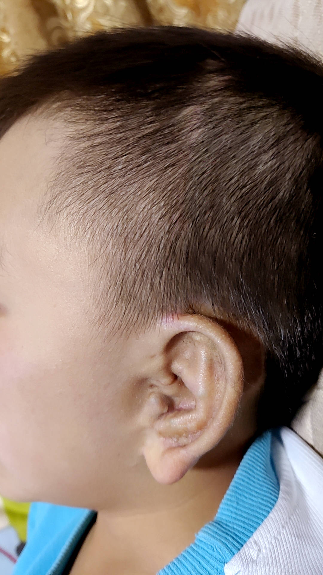 耳畸形手术几岁做合适-治疗的耳畸形专家 - 哔哩哔哩