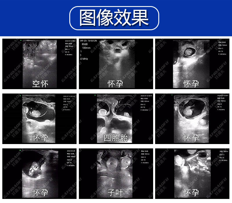 怀孕12周b超单图片图片