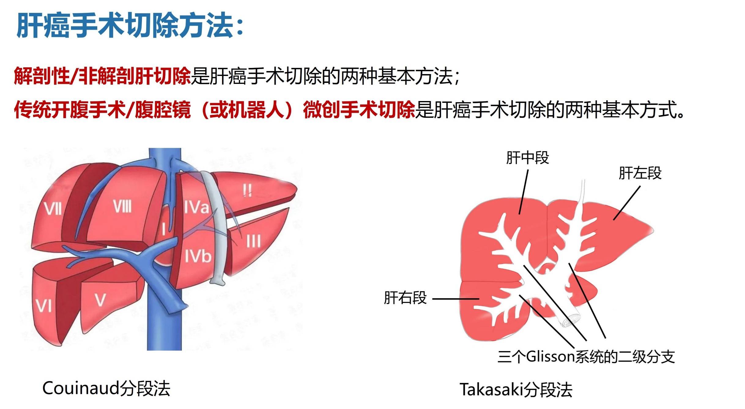 glisson鞘图片