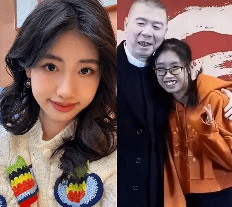 冯小刚养女的龅牙和他如出一辙,矫正牙齿,拒绝成为"小刚女"_基因_眼睛