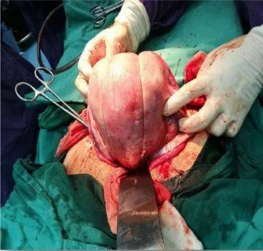 产科医生基本功华西专家手把手教阴道助产产科止血缝合技术