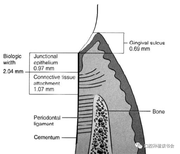 文献精读种植体周生物学宽度的概念及意义