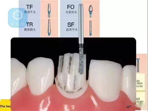 開髓去腐備牙破冠牙科車針的4大用途