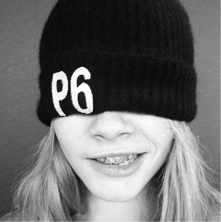 豪到没人性一个小小的牙齿要上万牙饰设计师实在是太疯狂了