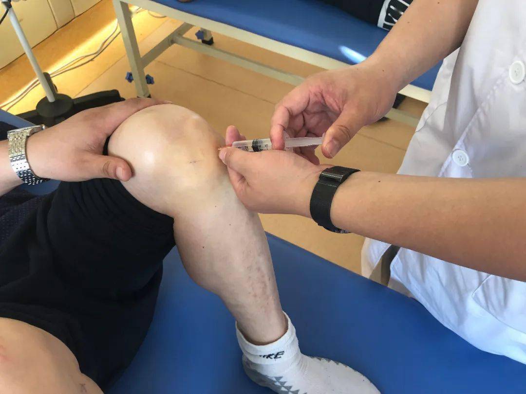 效果始终不明显,经康复医学科宋春雷主任诊断为膝关节骨性关节炎伴