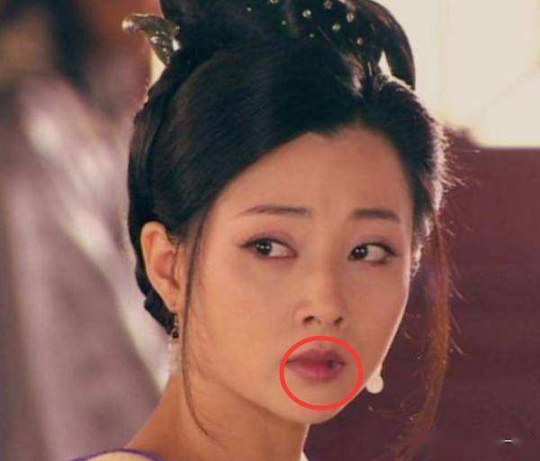 殷桃的嘴为什么总有个血痂之前以为是口疮后来才知道真相