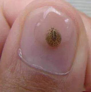 鱼病的肉眼快速诊断根据患病部位特征和病原种类的不同来判断鱼病