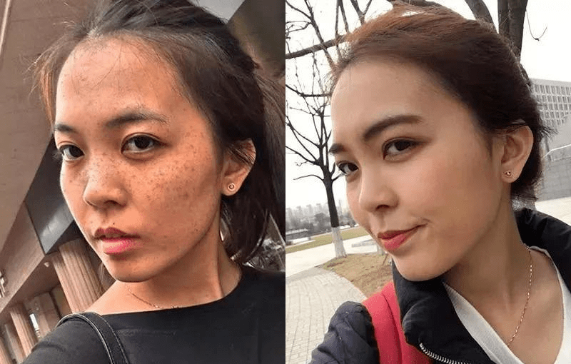 点击下图直接购买32岁的唐小姐,20多岁的时候脸上就开始有色斑,生完