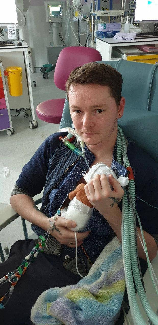 疫情期间出生的英国23周早产儿身体仅遥控器大小战胜3存活几率