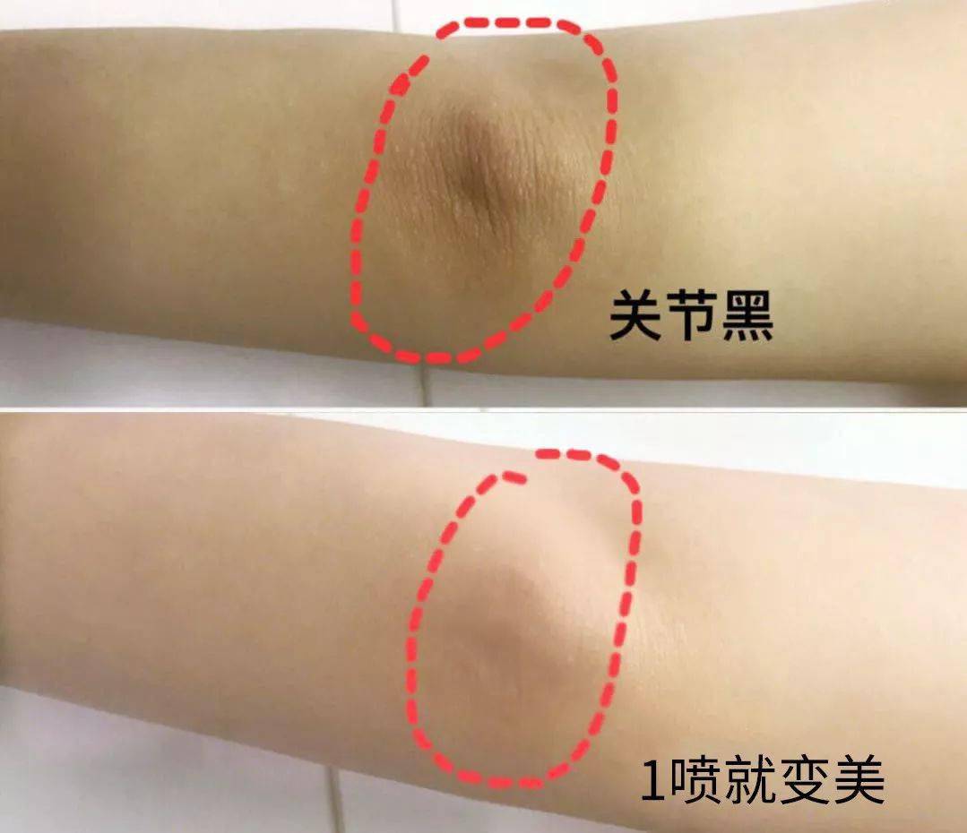 液体丝袜可以遮鸡皮肤吗(液体丝袜可以遮鸡皮肤吗女生)