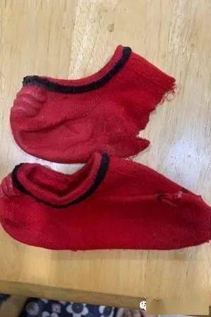 狗狗爱吞袜子她以为是喂太少吃不饱结果被医生一句话打脸