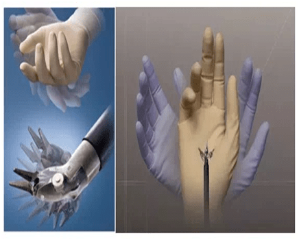 大医二院妇科1科应用达芬奇机器人手术成功保住患者子宫