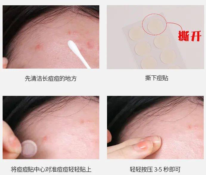 "拔"出黄脓,快速消痘!让肌肤变成"白煮蛋",就是这么简单!_痘痘