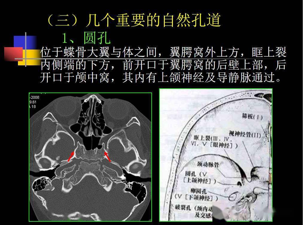 收藏必备鼻咽部的ct详细解剖